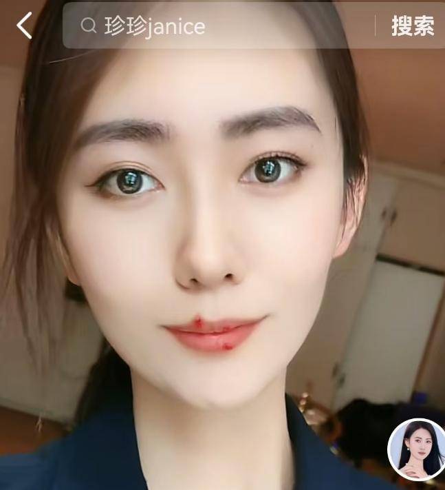 电梯亲吻门:宋珍珍19岁自曝报警无果看淡一切